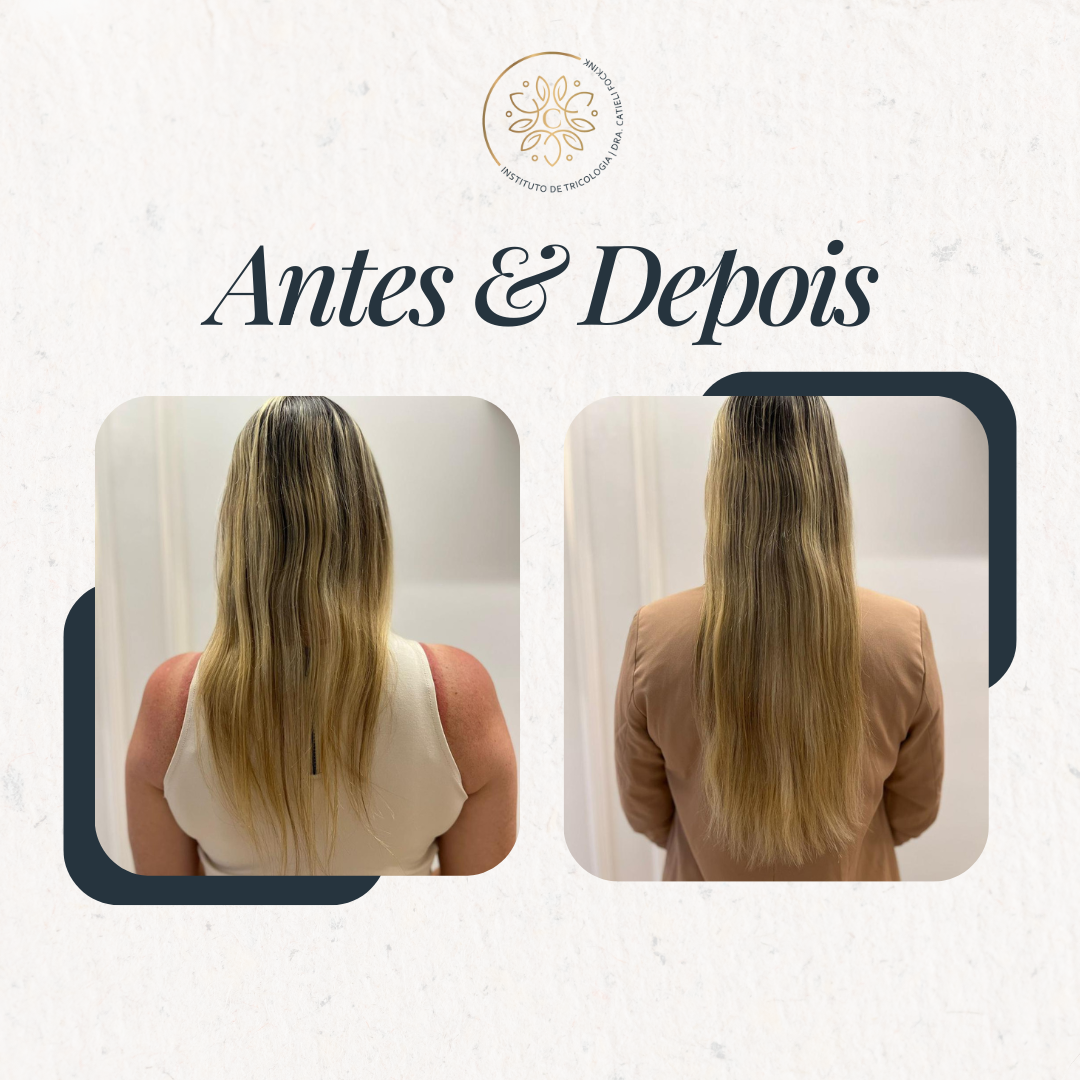 ANTES E DEPOIS (4)