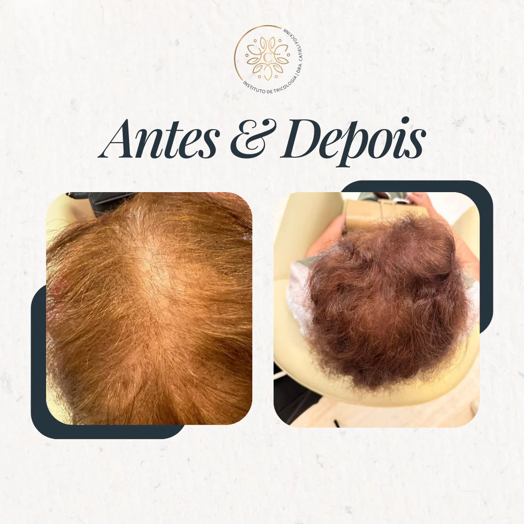 ANTES E DEPOIS (3)