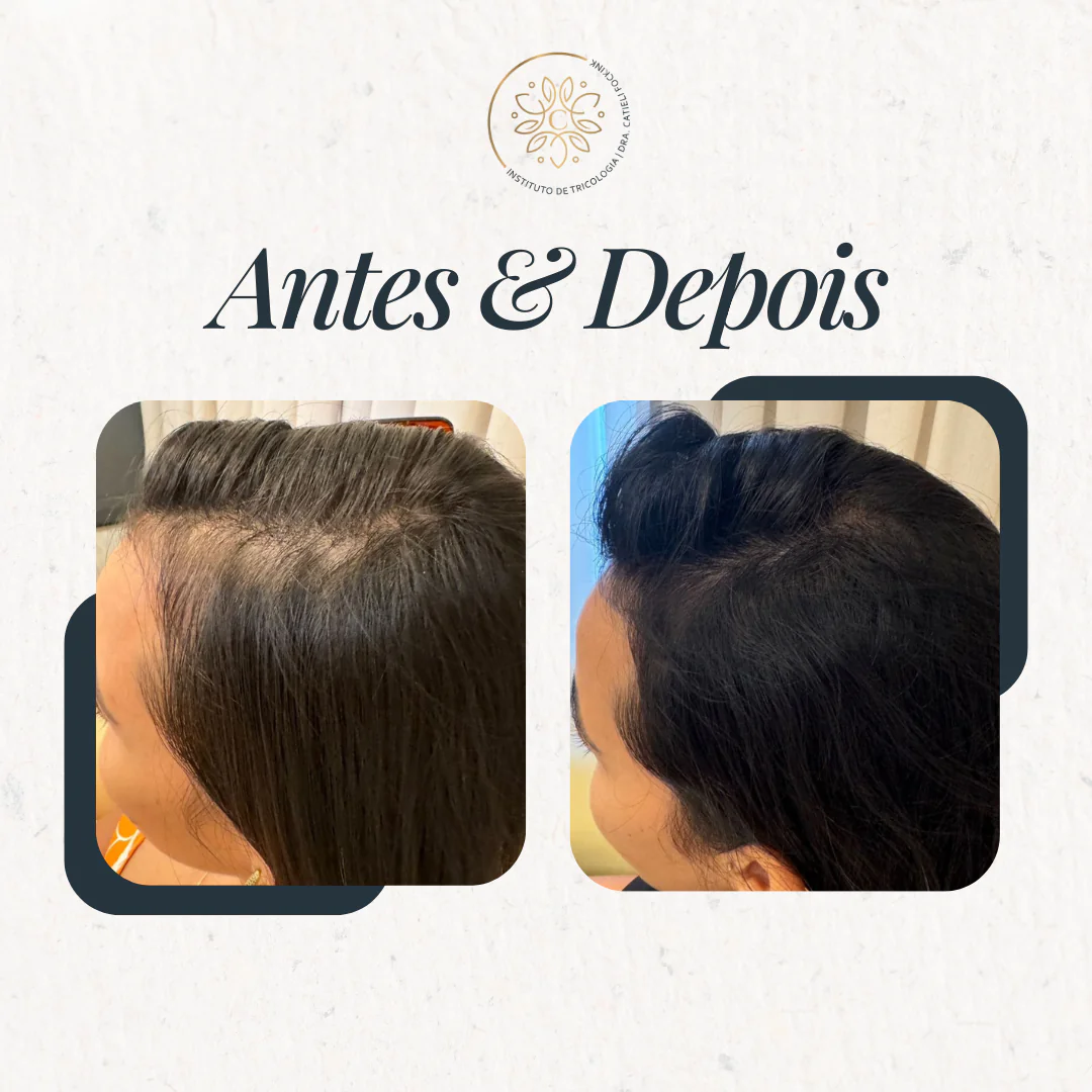 ANTES E DEPOIS (5)